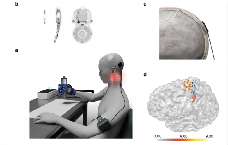 全球首张侵入式脑机接口医疗器械获批上市